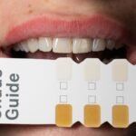 brasssmile com review guide