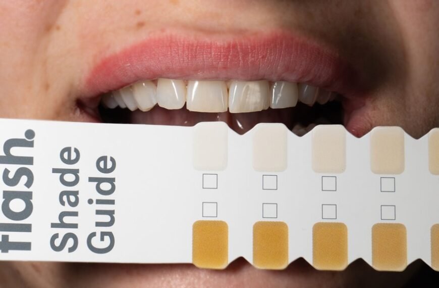 brasssmile com review guide